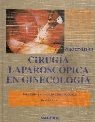 Cirugia laparoscopica en ginecologia