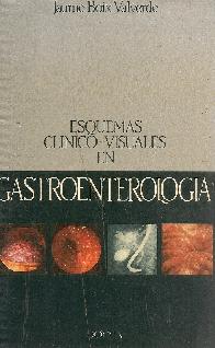 Esquemas clinico-visuales en gastroenterologia