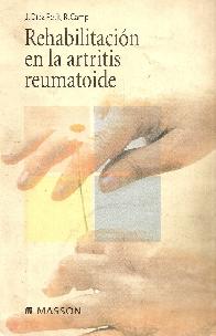 Rehabilitacion en la artritis reumatoide