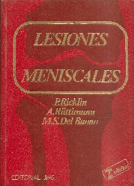 Lesiones meniscales