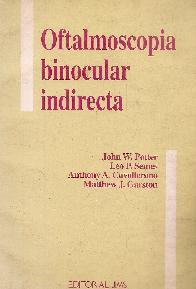 Oftalmoscopia binocular indirecta