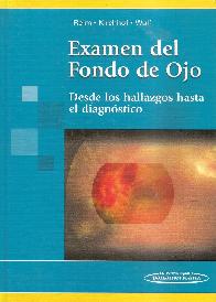Examen de Fondo de Ojo