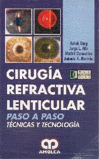 Ciruga Refractiva Lenticular