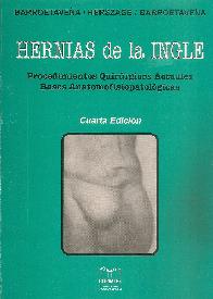 Hernias de la Ingle