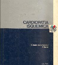 Cardiopatia isquemica