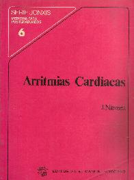 Arritmias Cardiacas