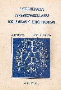Enfermedades cerebro vasculares isquemicas y hemorragicas