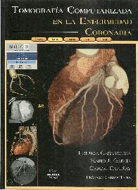 Tomografa Computarizada en la Enfermedad Coronaria