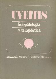 Uveitis Kraus