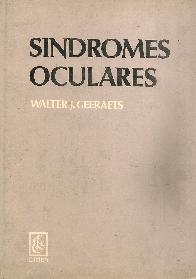 Sindromes Oculares