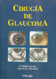 Cirugia de glaucoma
