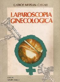 Laparoscopia ginecologica