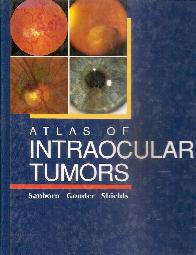 Atlas of intraocular tumors