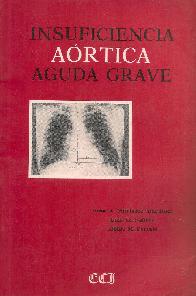 Insuficiencia aortica aguda grave