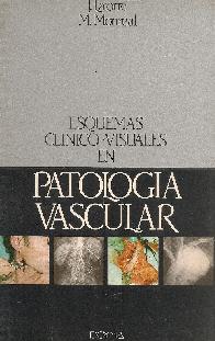Esquemas clinico-visuales en patologia vascular