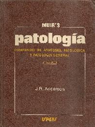 Patologia de Muirs