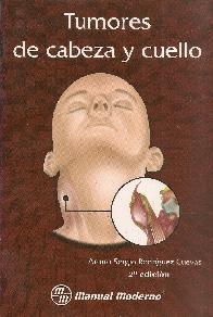 Tumores de cabeza y cuello