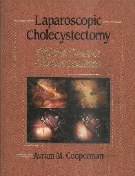 Laparoscopic Cholecystectomy