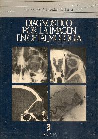Diagnostico por la imagen en oftalmologia