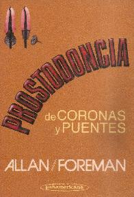 Prostodoncia de coronas y puentes