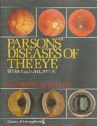 Parsons Diseases of eyes