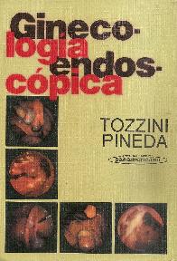 Ginecologia endoscopica