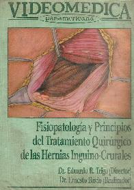 VIDEO Fisiopatologia y principios del tratamiento quirurgico de las hernias inguino-crurales -VIDEO-