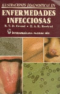 Ilustraciones diagnosticas en enfermedades infecciosas
