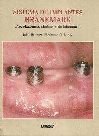 Sistema de implantes Branemark