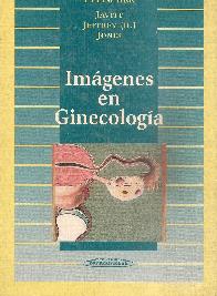 Imagenes en Ginecologia