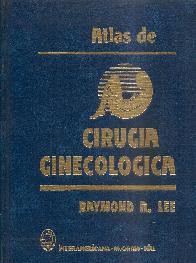 Atlas de cirugia ginecologica