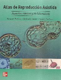 Atlas de reproduccion asistida