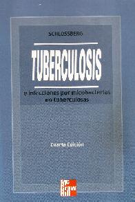 Tuberculosis e infecciones por micobacterias no tuberculosas