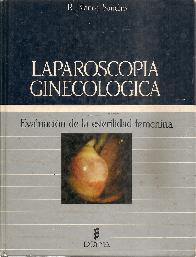 Laparoscopia ginecologica