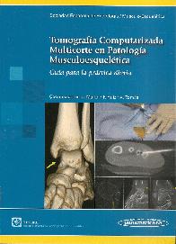 Tomografa Computarizada Multicorte en Patologa Musculoesqueltica