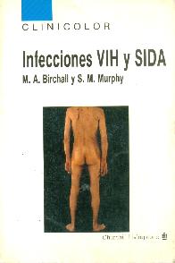 Infecciones VIH y SIDA