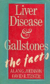 Liver Disease and gallstones the facts