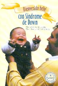 Bienvenido Bebe con Sindrome de Down