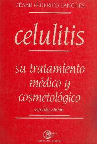 Celulitis