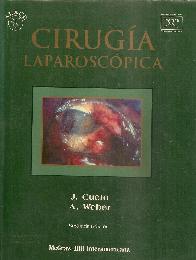 Cirugia Laparoscopica