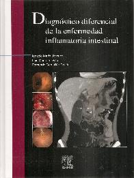 Diagnstico diferencial de la enfermedad inflamatoria intestinal