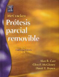 Prtesis Parcial Removible McCracken