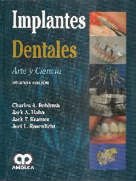 Implantes Dentales