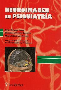 Neuroimagen en psiquiatra