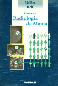 Casos en radiologia de mama