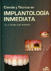 Ciencia y Tecnica en Implantologia Inmediata - 2 Tomos