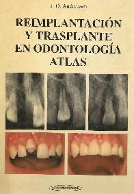 Reimplantacion y transplante en odontologia