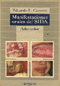Manifestaciones orales del sida