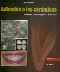 Adhesion a las ceramicas