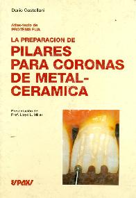 La preparacion de pilares para coronas de metalceramica atlas texto de protesis fija